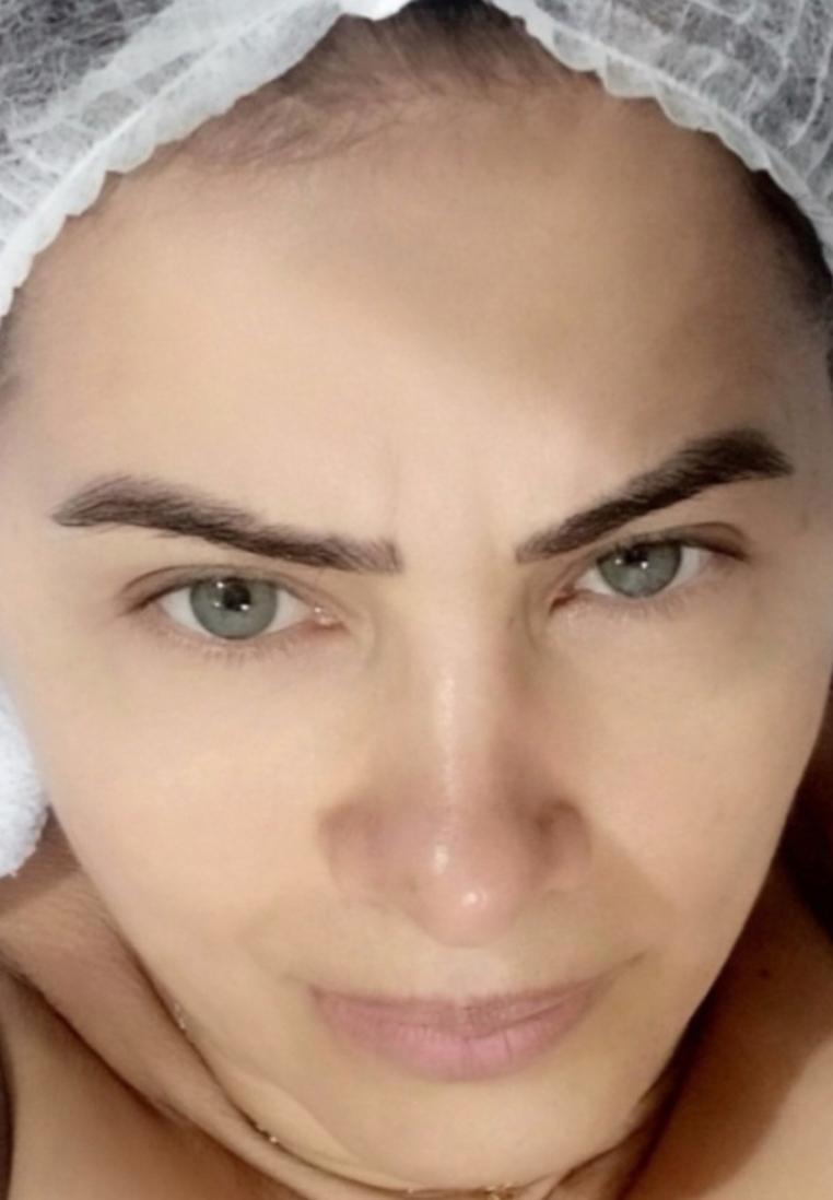Spaço Clean Depilação a Laser 