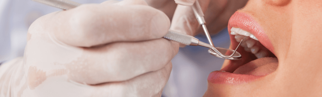Dentista pode ser MEI? Descubra como abrir empresa