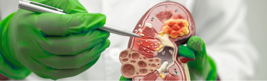 CNAE 8640-2/13 – Serviços de litotripsia: Simples Nacional, Fator R e abertura de empresa