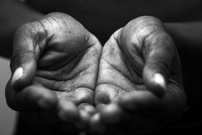 Política como expressão viva de caridade