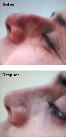 Ljubica Malinarich Sarabia-8