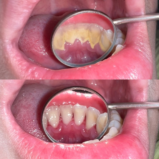 Valentina Monserrat Montecinos Gutiérrez-9