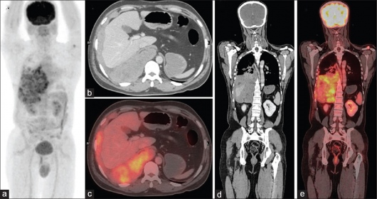 Oscar Aguilera Bazán-8