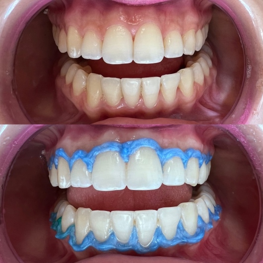 Valentina Monserrat Montecinos Gutiérrez-8