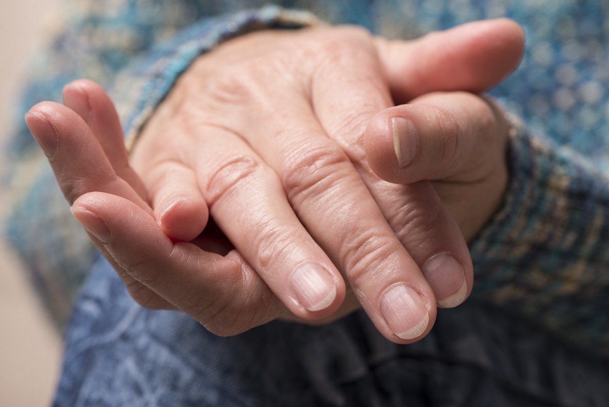 Estrias nas unhas: entenda as causas e quando buscar ajuda médica