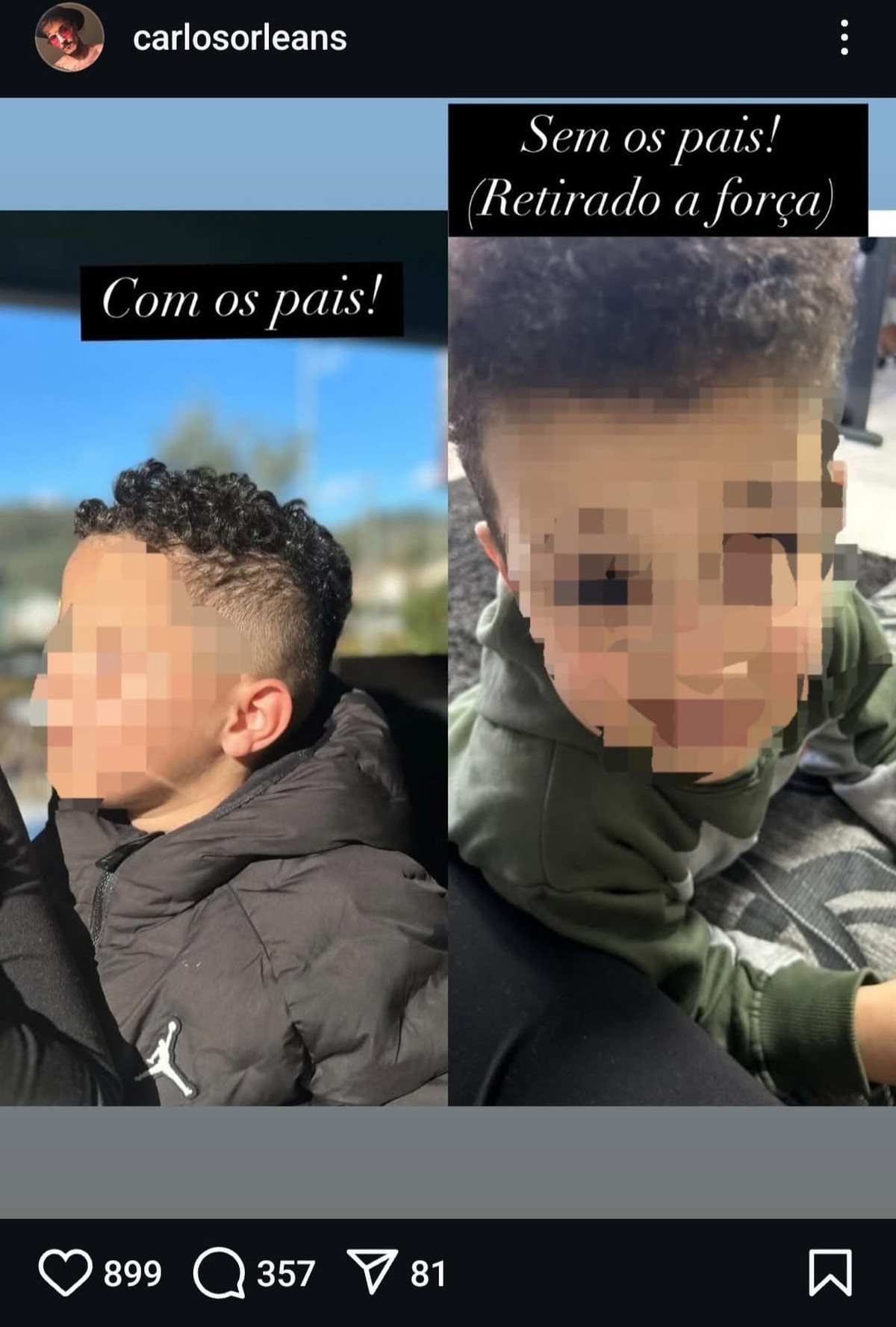 Carlos publicou imagem de Y. antes e depois da retirada da guarda (Foto: Reprodução/Instagram @carlosorleans)