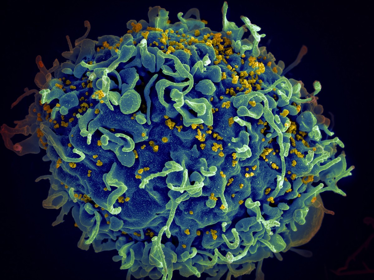 Vacinas de RNAm contra HIV mostram forte resposta imune em novo estudo