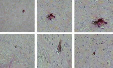 Vacina contra o vírus zika apresenta resultados promissores em testes com roedores