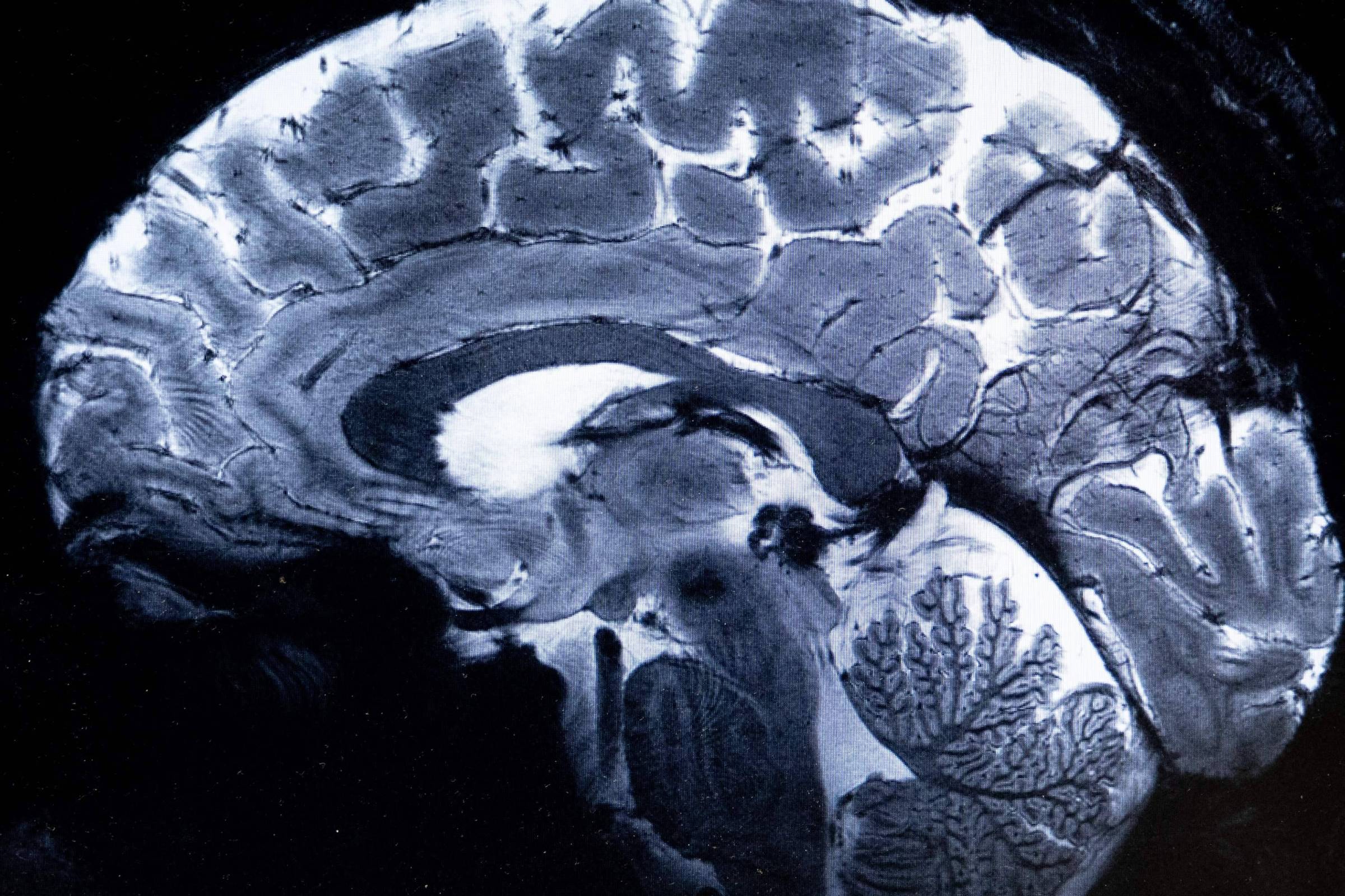 As memórias podem ser formadas por diferentes conexões cerebrais, revela estudo (Foto: Alain Jocard/AFP)