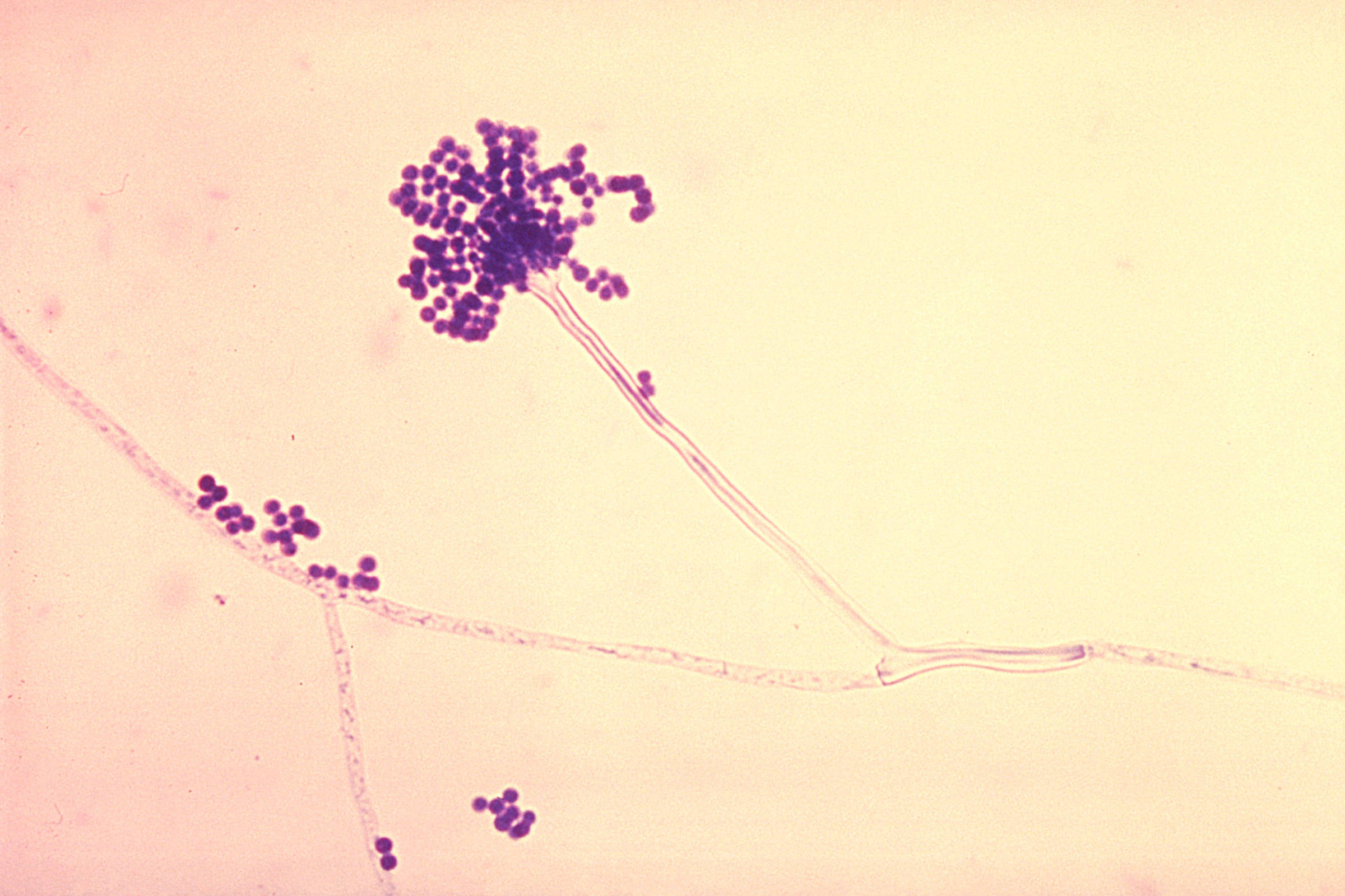 Mudanças climáticas ampliam a ameaça de fungos mortais como Aspergillus no mundo