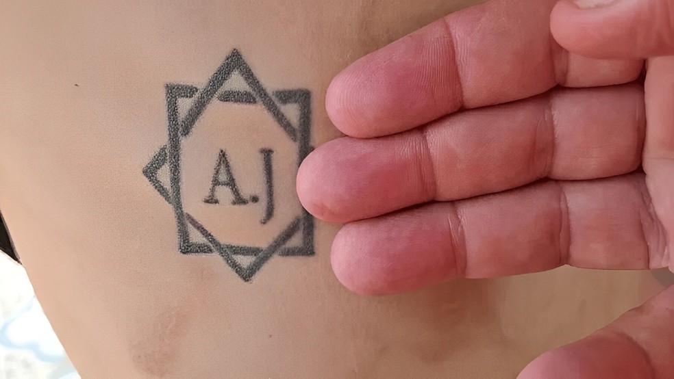 Iniciais de patrões aliciadores foram tatuadas na vítima para representar "posse", segundo o Ministério do Trabalho e Emprego (MTE). (Foto: MTE/Divulgação)