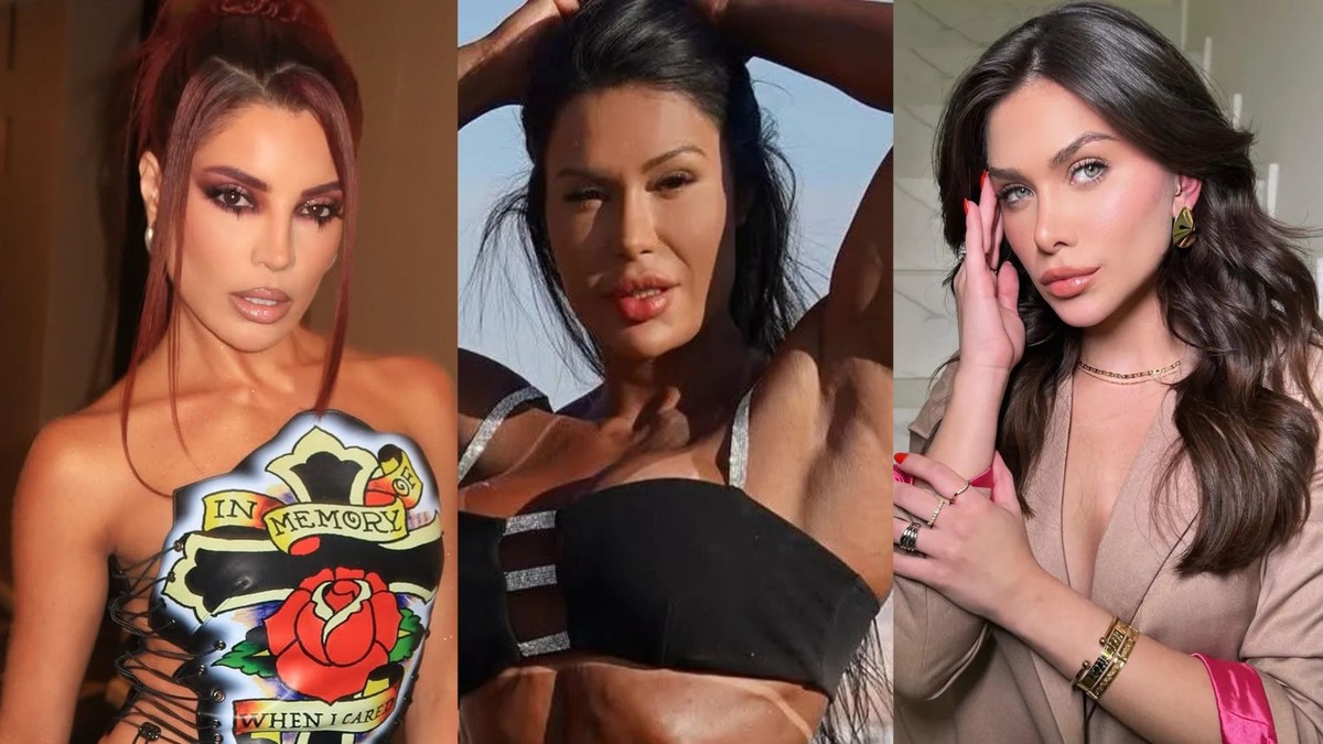 Celebridades como Gkay, Flavia Pavanelli, Lucas Lucco e Gracyanne Barbosa optaram por reverter ou suavizar harmonizações faciais. O interesse por resultados sutis e difíceis de identificar — o chamado “efeito indetectável” — cresce. (Foto: Reprodução)