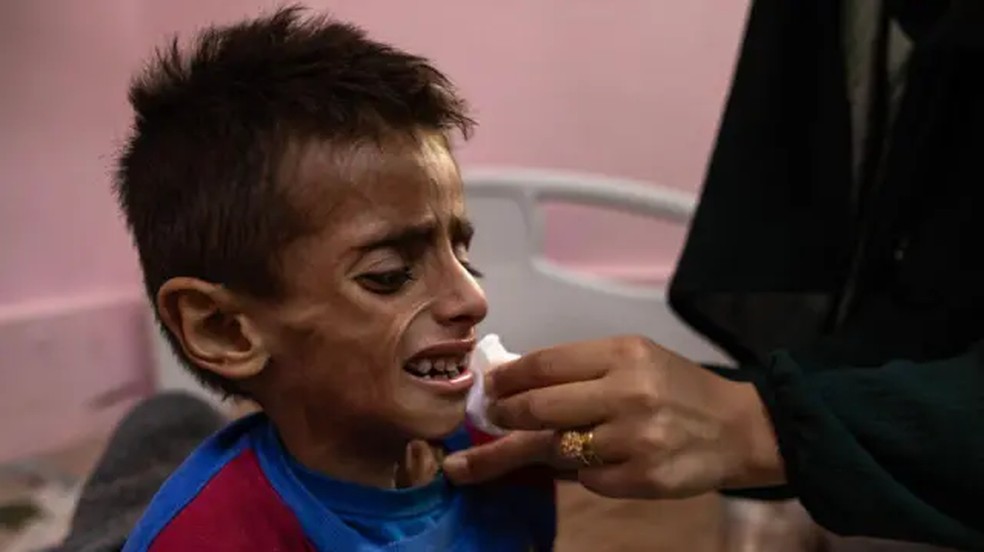 Fome extrema em Gaza provoca crise humanitária e sofrimento sem precedentes