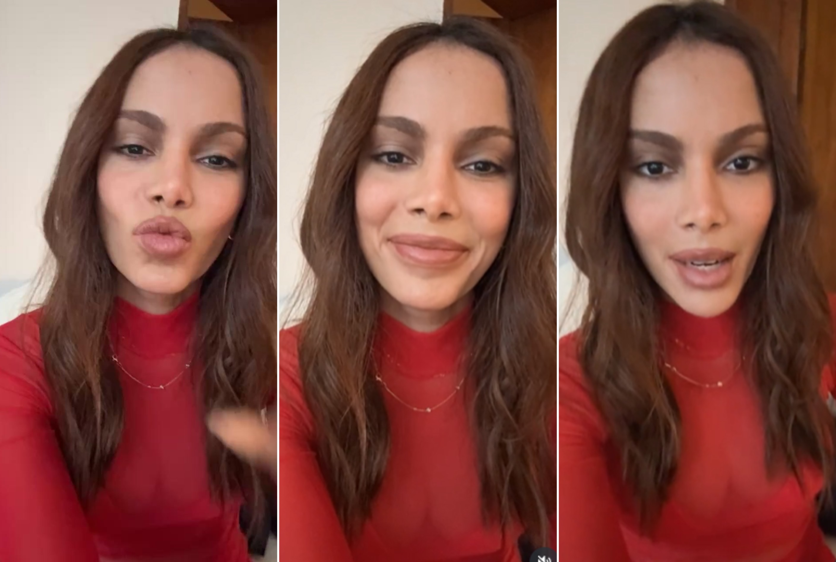 Anitta fala sobre procedimentos faciais e seu impacto na carreira musical