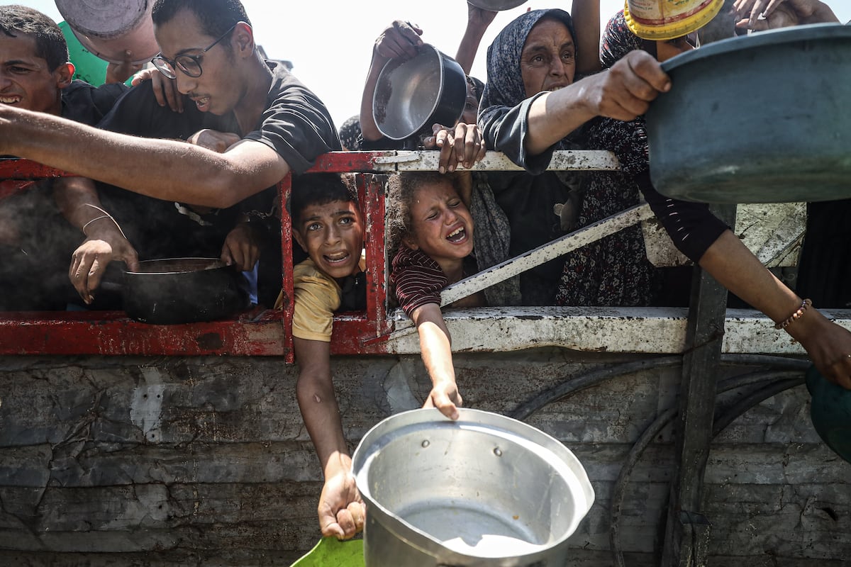 Guerra em Gaza provoca desnutrição alarmante entre crianças, alerta ONU
