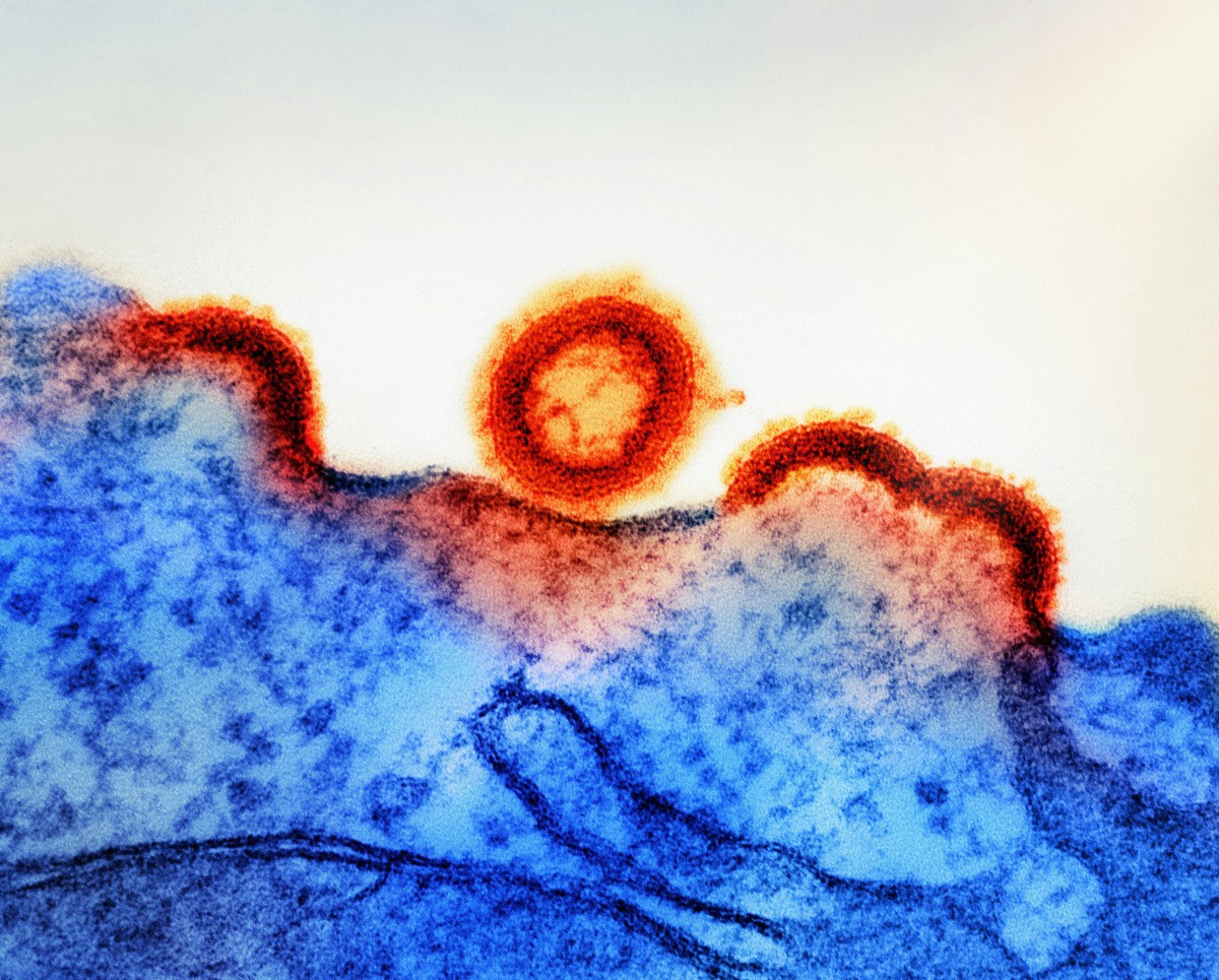 Cientistas descobrem tratamento inédito para prevenir o HTLV-1, vírus semelhante ao HIV