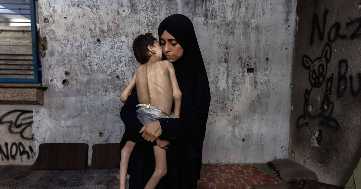 Enfermeiros em Gaza enfrentam a fome em meio à crise humanitária crescente