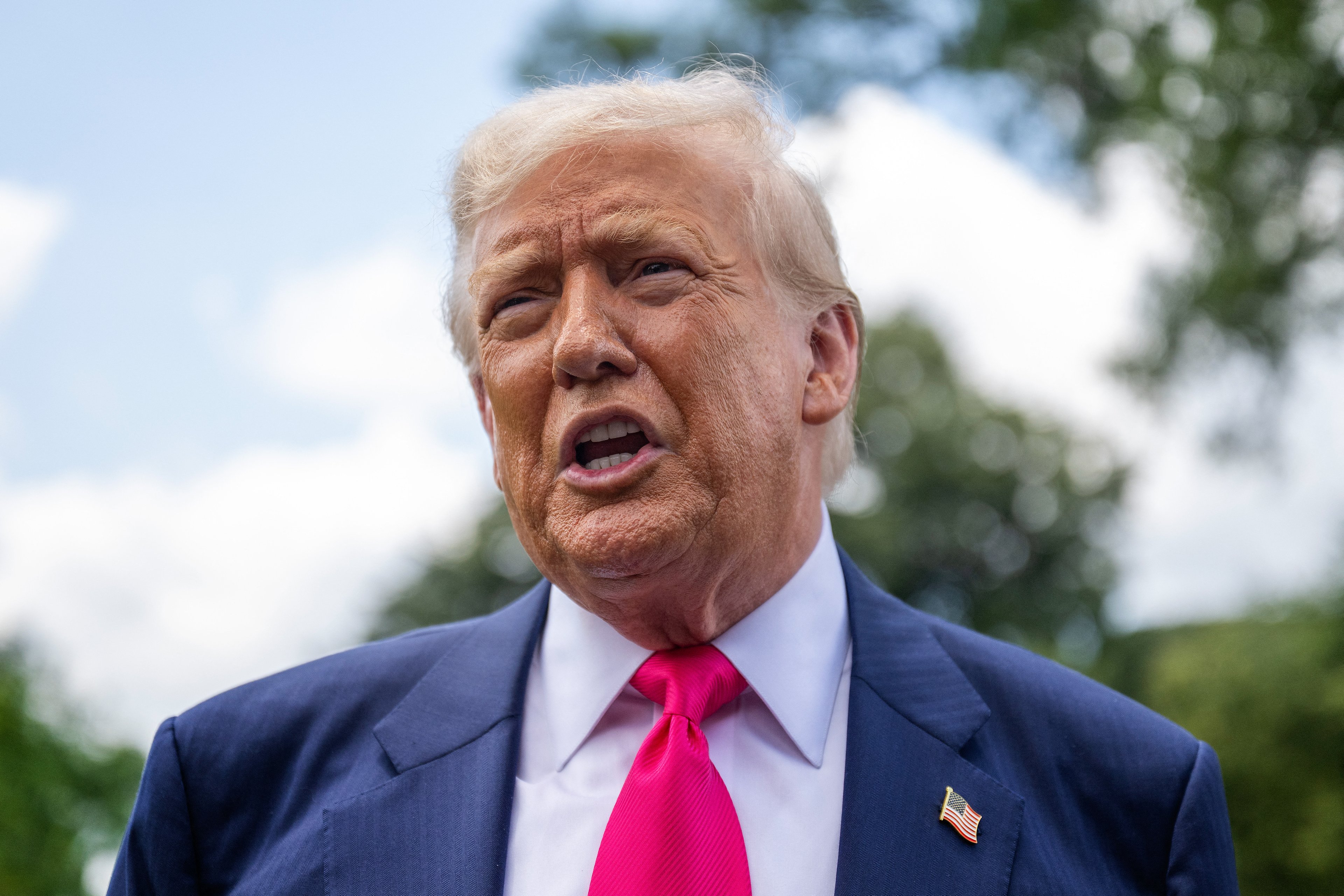 Trump é diagnosticado com insuficiência venosa crônica após inchaço nos tornozelos