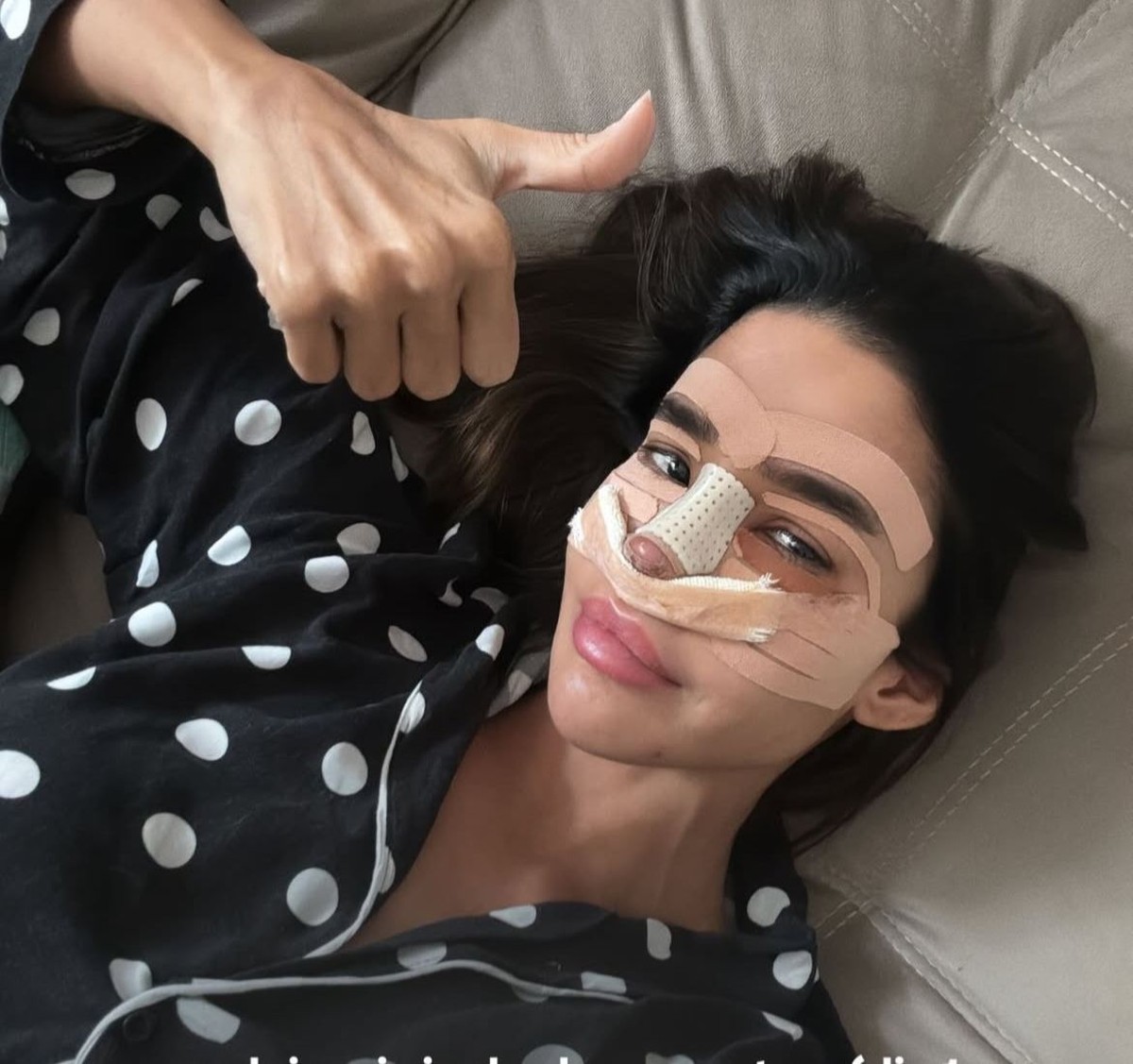 Kerline revela rosto inchado após cirurgia e rotina intensa de cuidados nasais