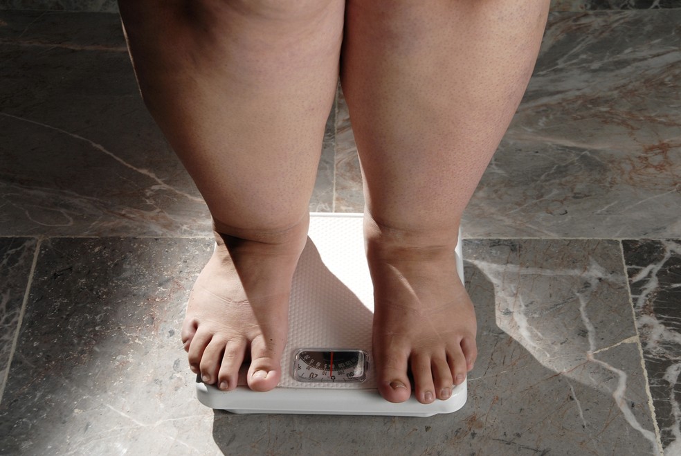 Bariátrica é a principal cirurgia para casos de obesidade grave (Foto: iStock)