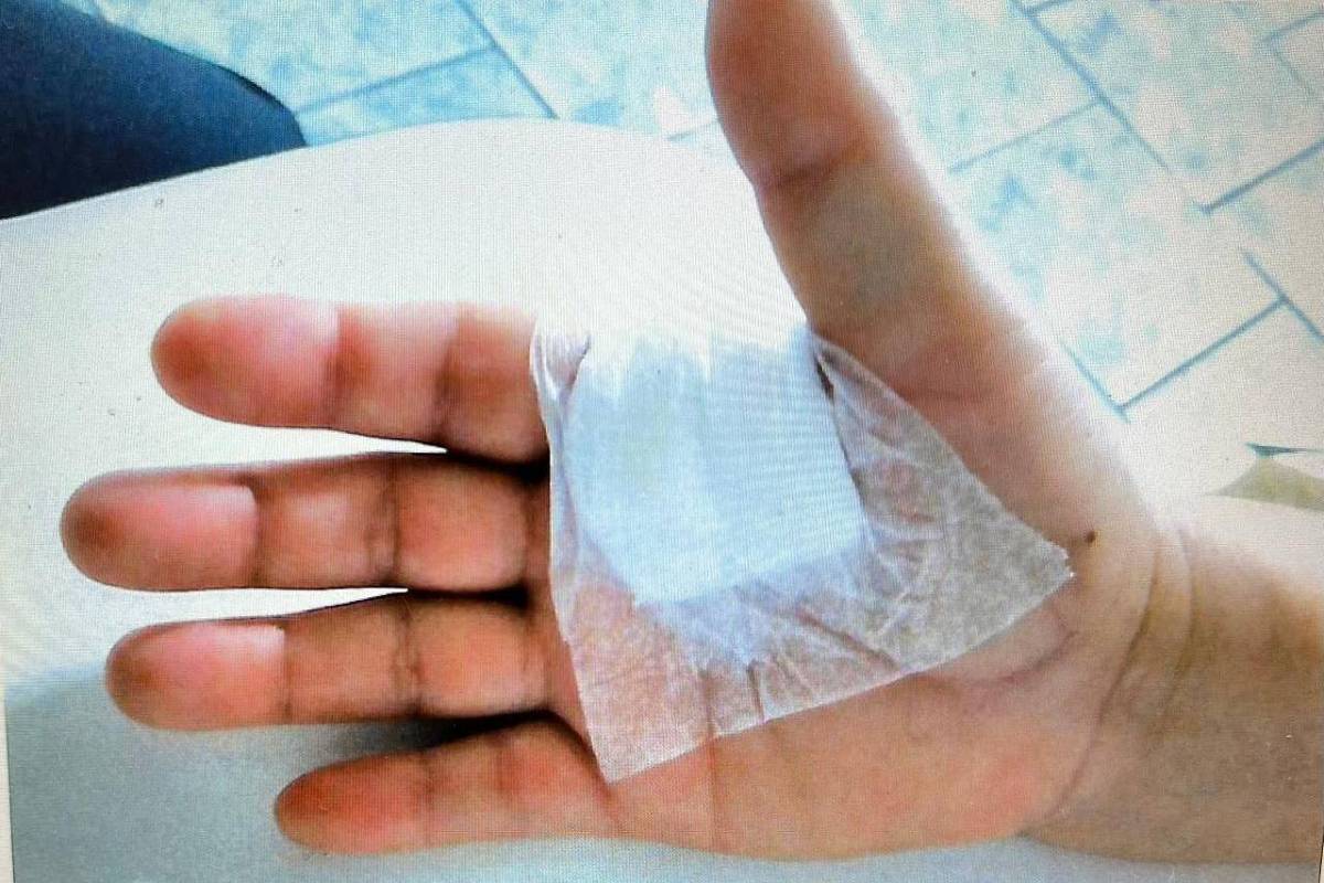 Médico é condenado por realizar cirurgia no dedo errado de paciente em SP