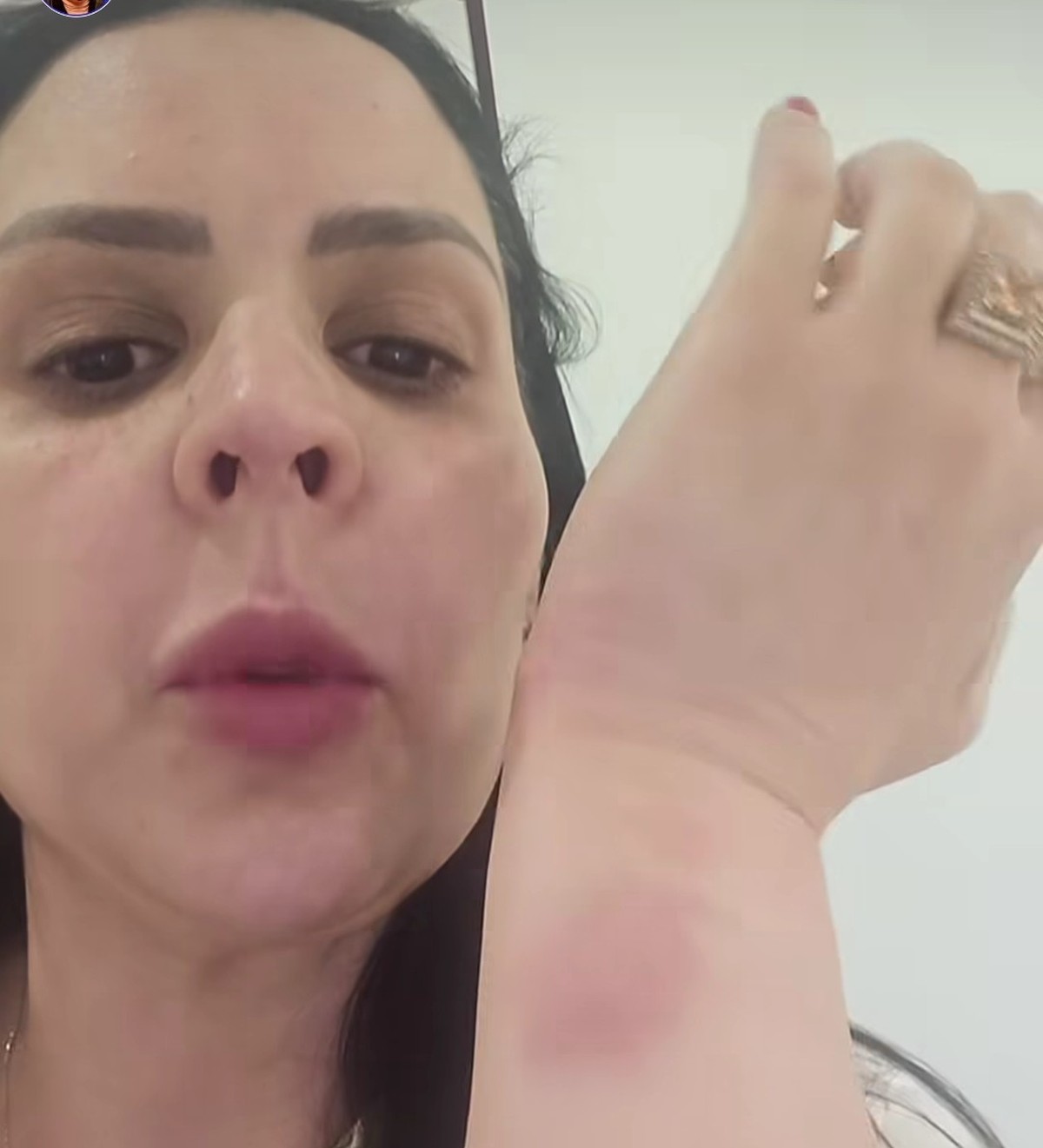 Priscila Corrêa mostra a marca da algema em um dos pulsos. (Foto: Reprodução)