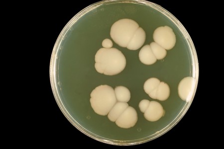 Terapia a laser melhora eficácia no combate a fungos resistentes a medicamentos