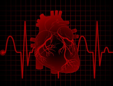 Variações na glicose revelam gravidade do dano após infarto cardíaco