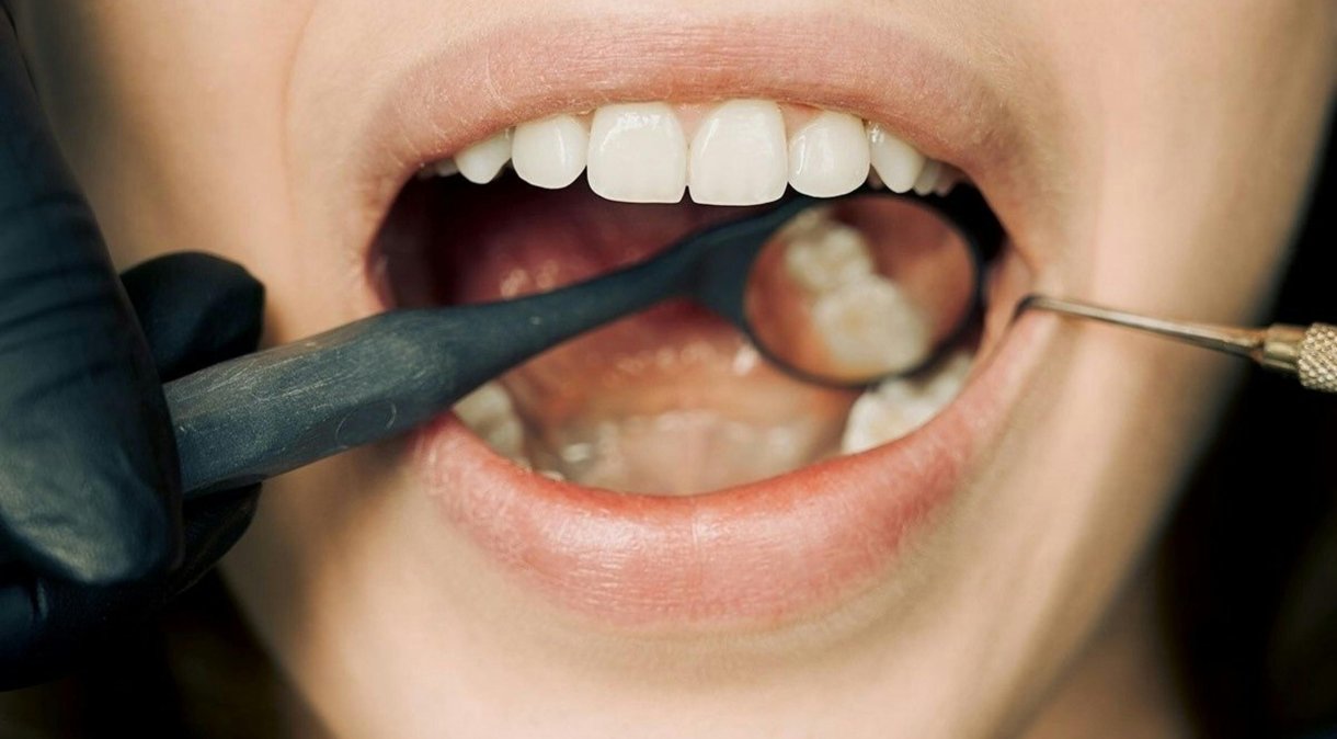 A saúde bucal impacta diretamente o funcionamento de demais sistemas do corpo. (Foto: Pexels)