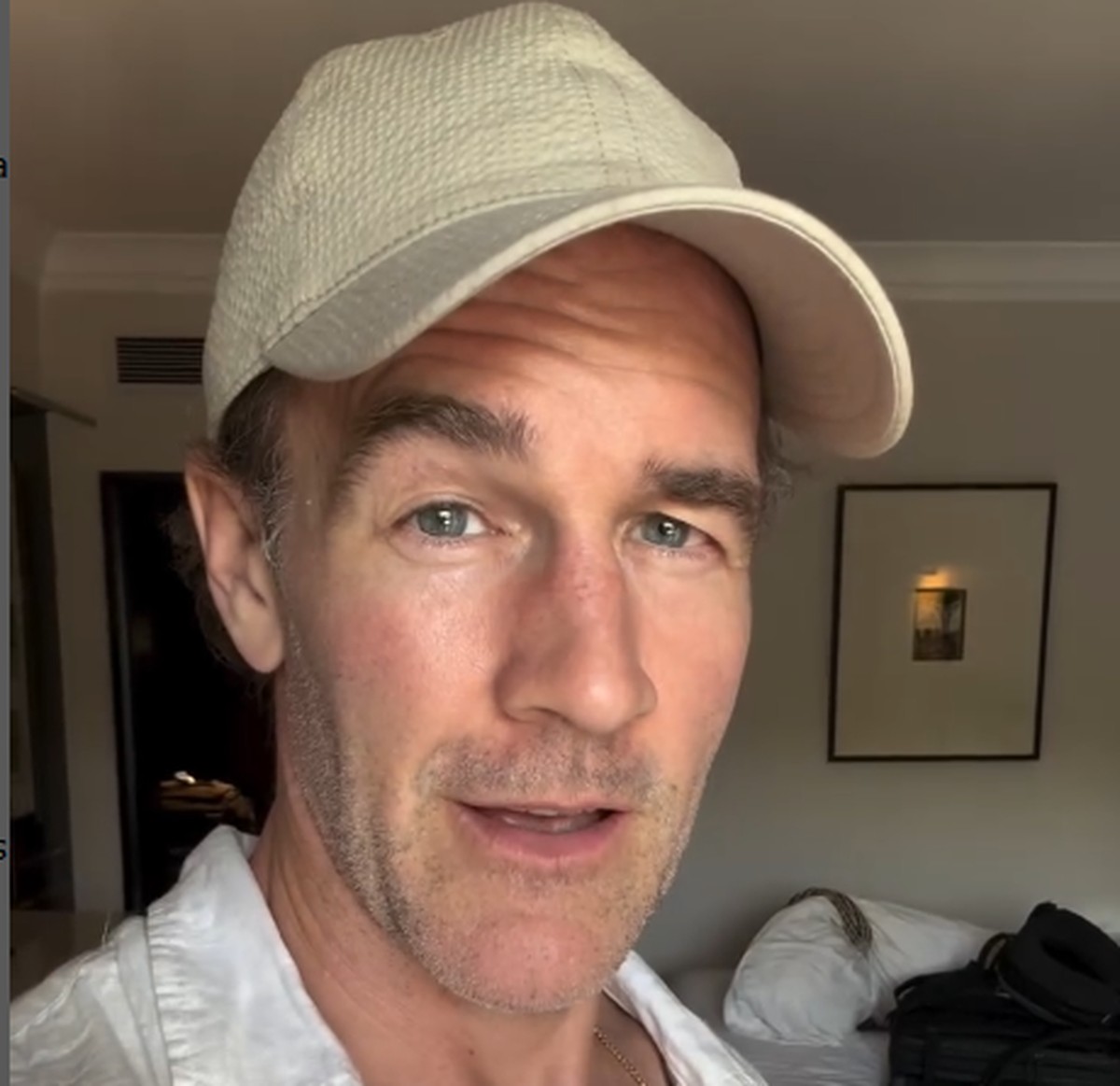 Ator de 'Dawson’s Creek' revela que ignorou sintoma do câncer de intestino