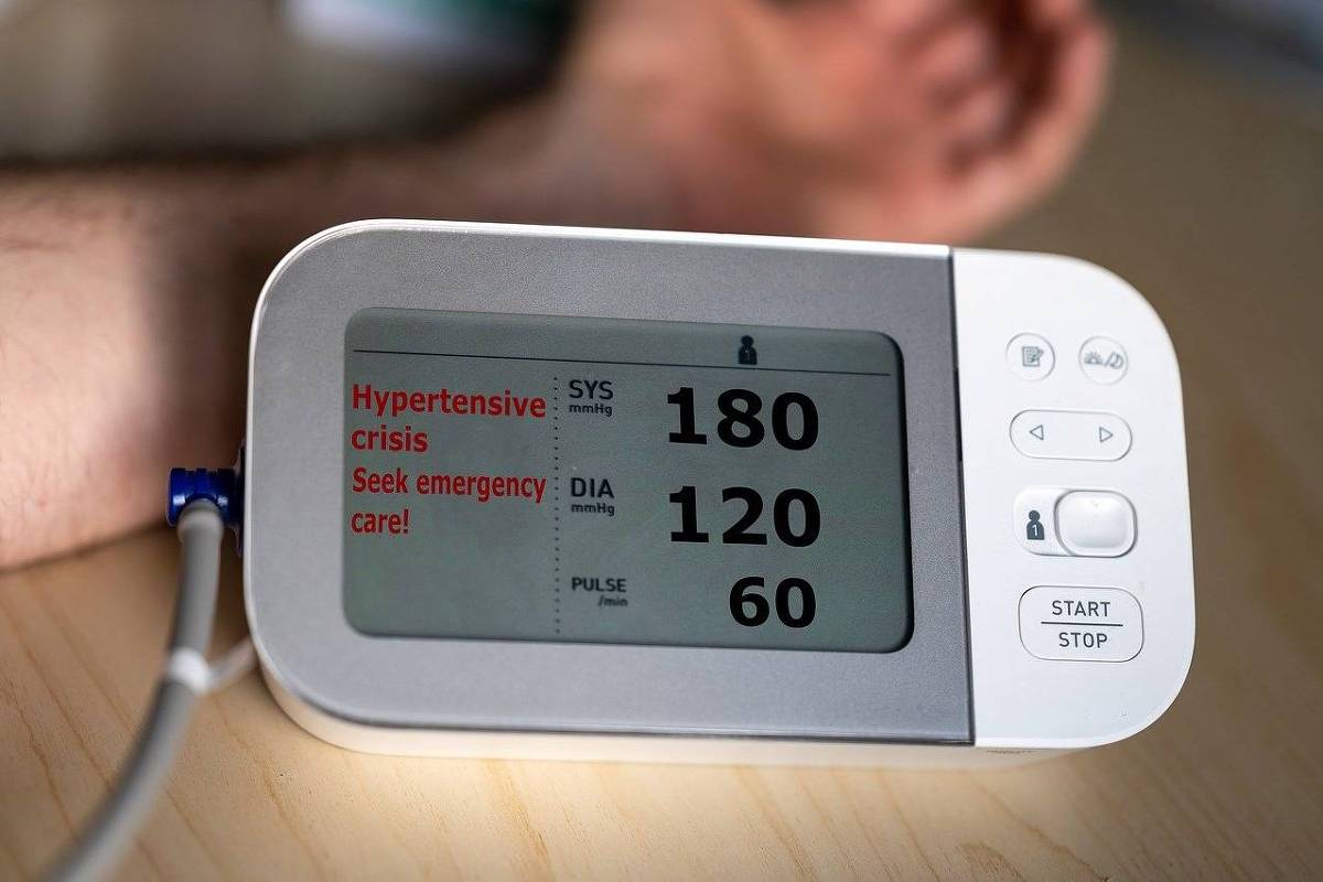 AVC é a principal causa de morte cardíaca no Brasil e carece de prevenção no SUS