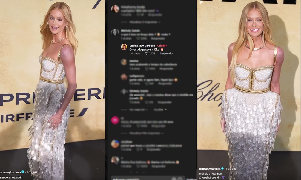 Marina Ruy Barbosa explica motivo de braço roxo durante baile da amfAR, em Cannes. (Foto: Reprodução/Instagram)