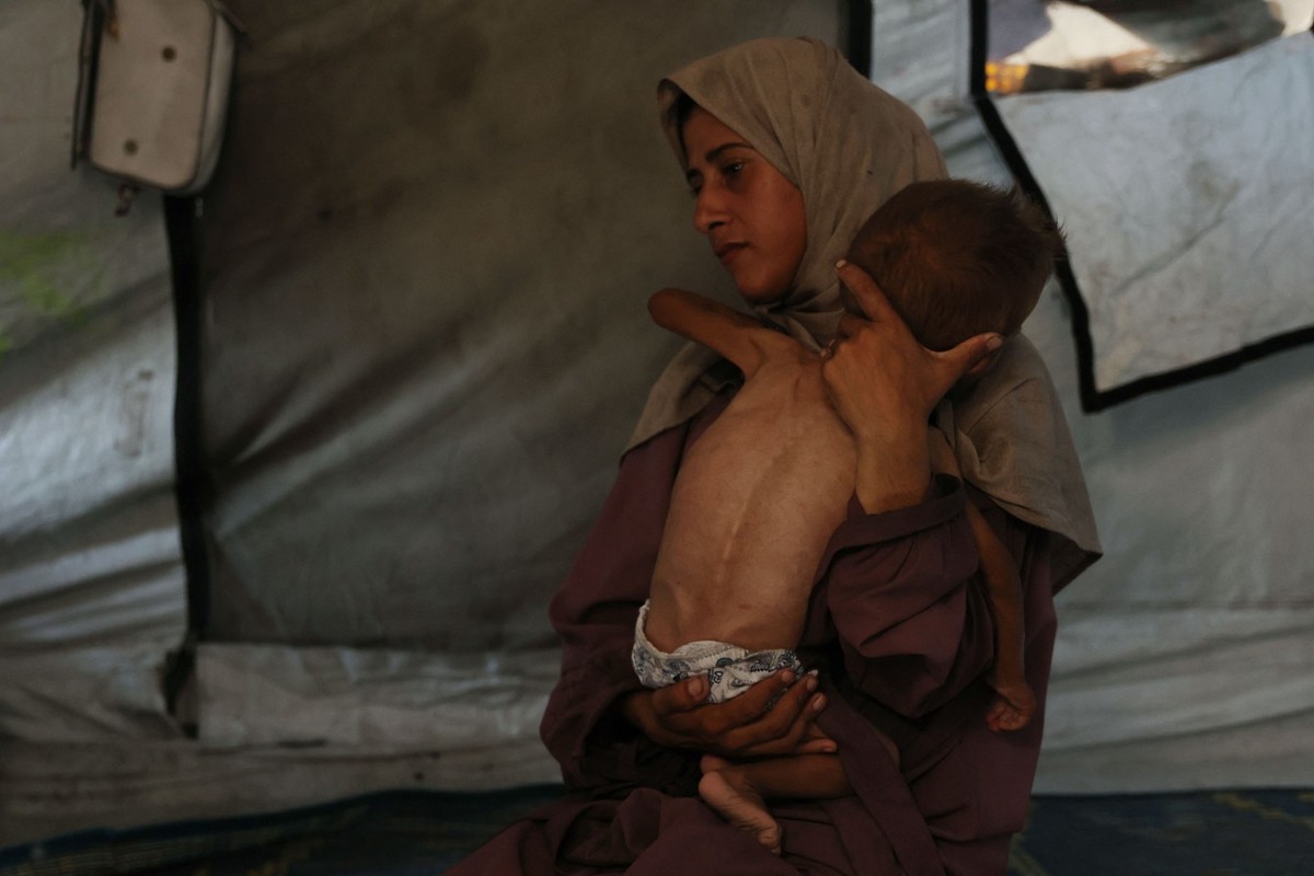 Desnutrição em Gaza atinge níveis alarmantes, alerta OMS sobre crise humanitária