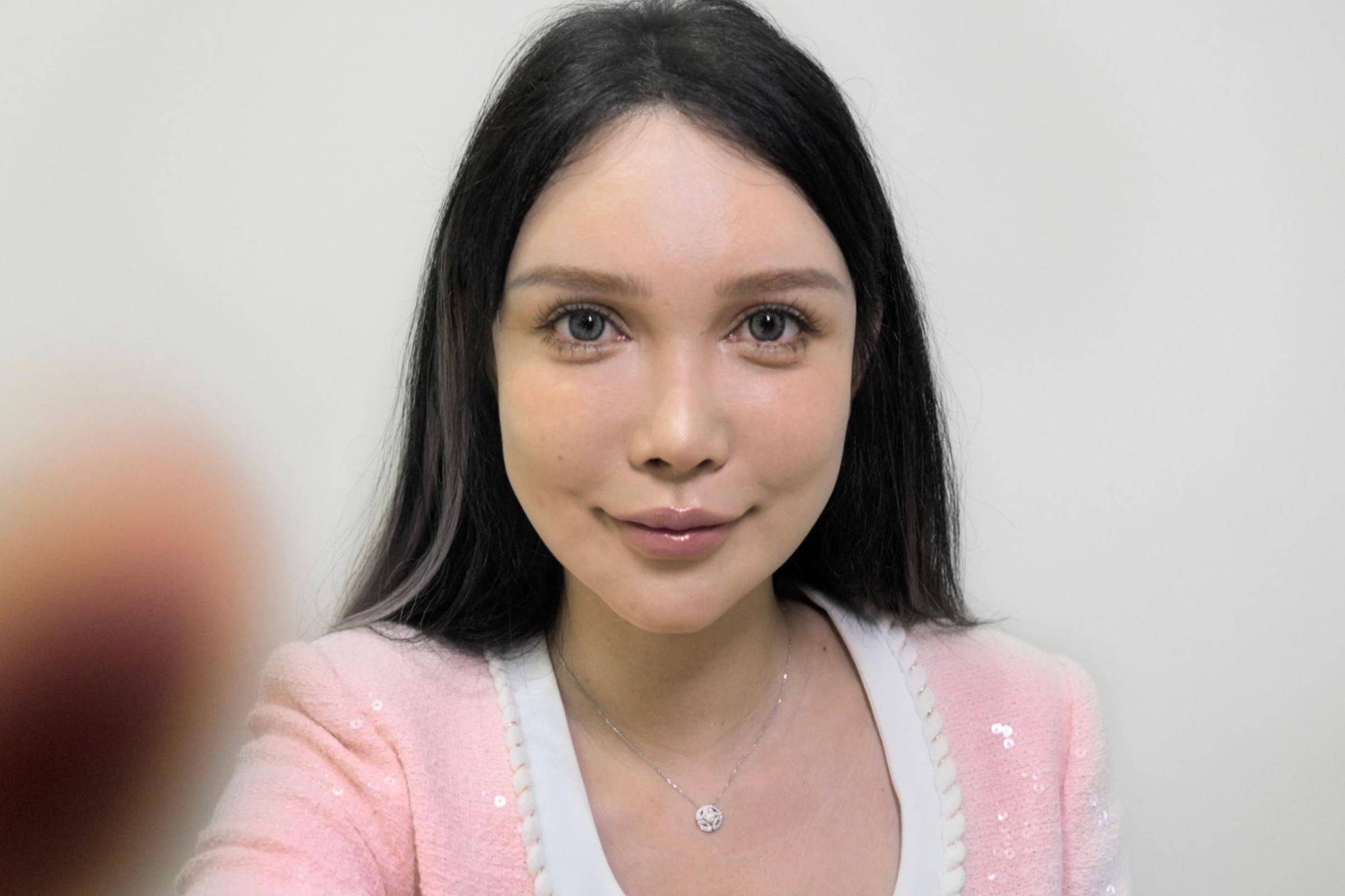 Abby Wu, que passou por mais de 100 operações, é uma das primeiras influenciadoras de cirurgia plástica da China (Foto: Reprodução)