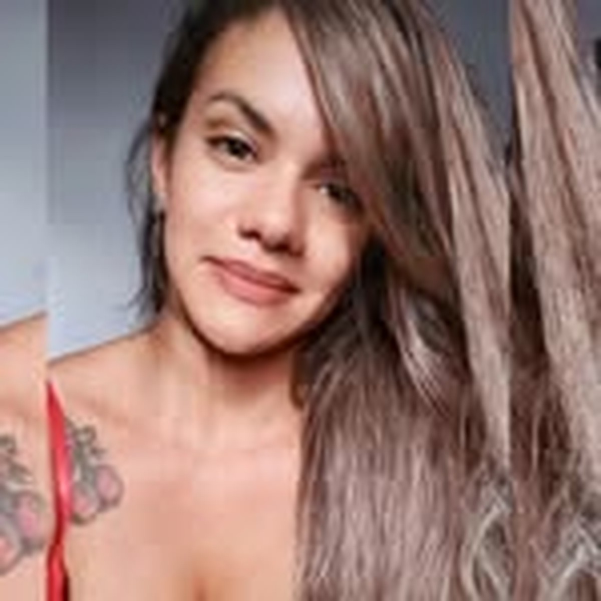 Mulher agredida pelo namorado com 61 socos passa por cirurgia de reconstrução