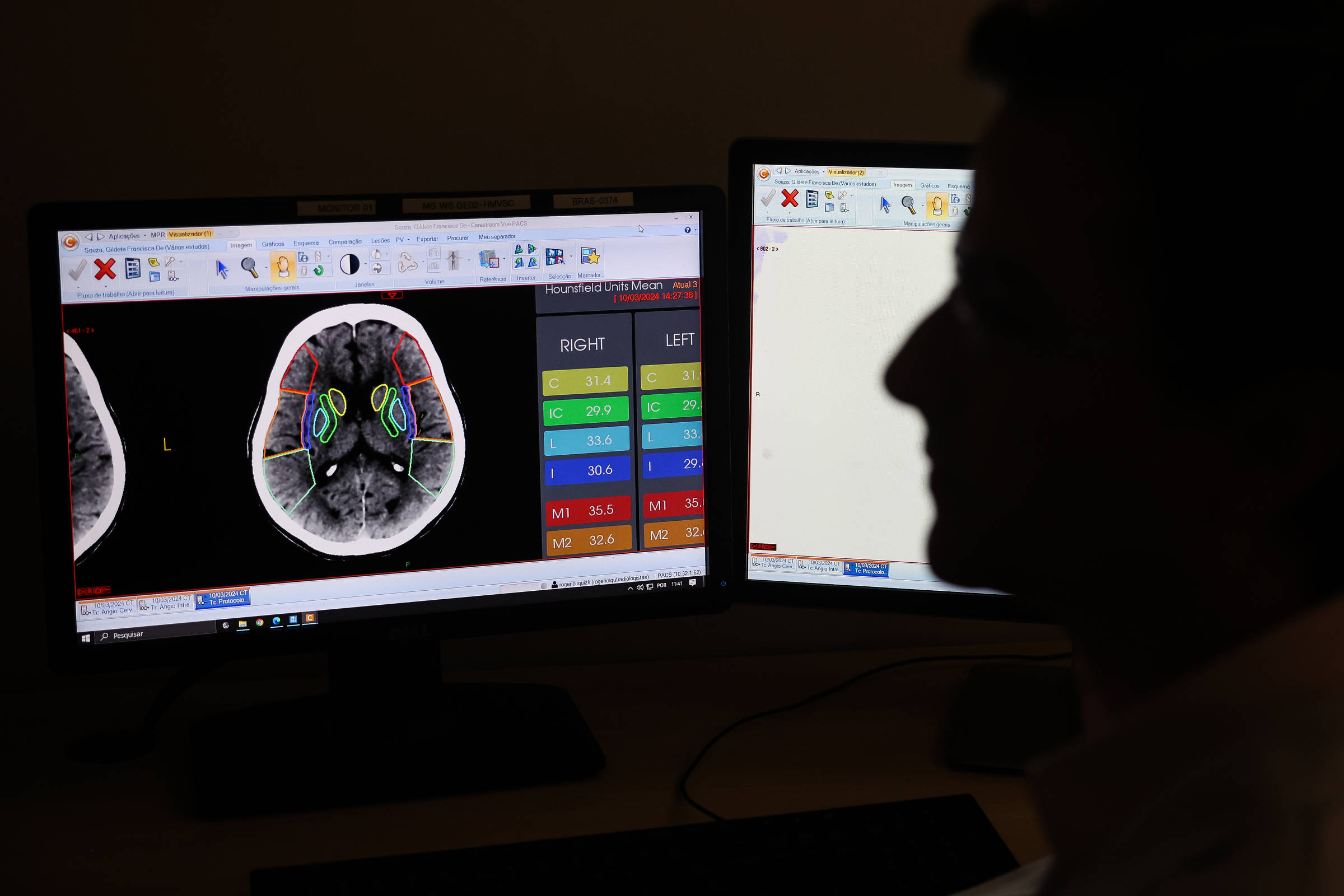 Inteligência artificial promete diminuir desigualdades sociais e econômicas