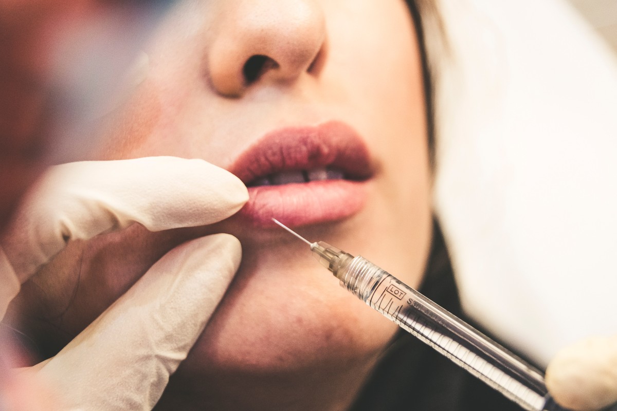 Preenchimento labial (Foto: Unsplash)