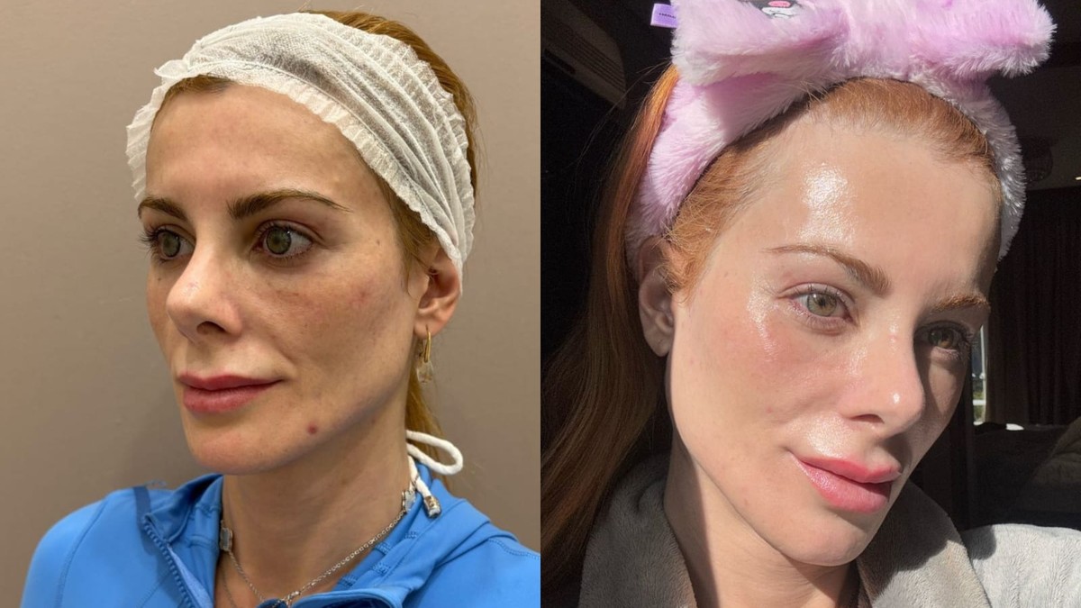 Deborah Albuquerque revela como manter a pele jovem com rotina de beleza coreana