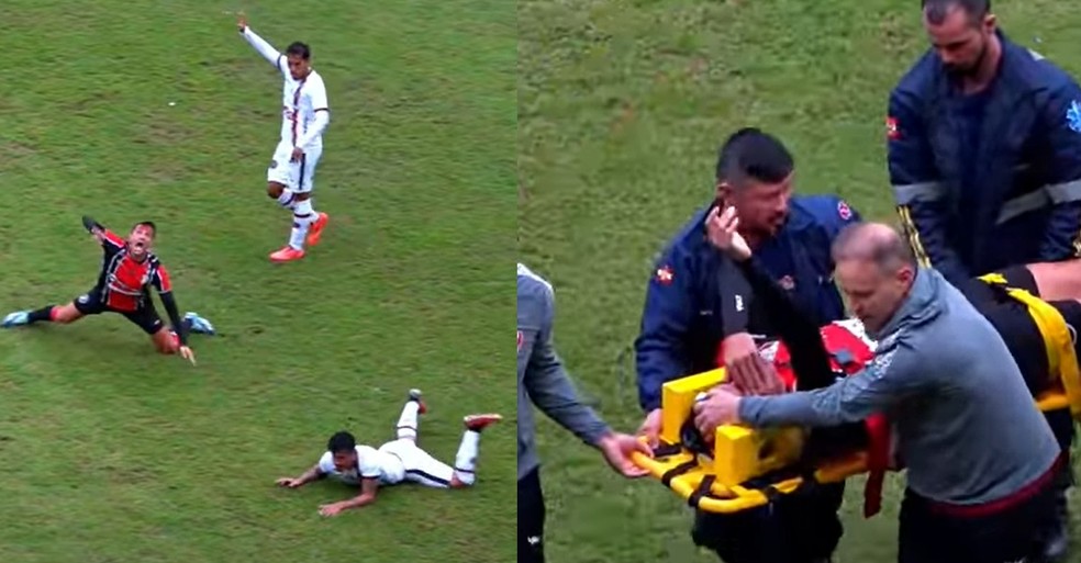 Atleta do Joinville sofre corte na cabeça após choque em jogo da Série D