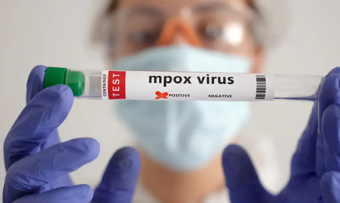 África registra quase 50 mil casos confirmados de mpox em recente surto