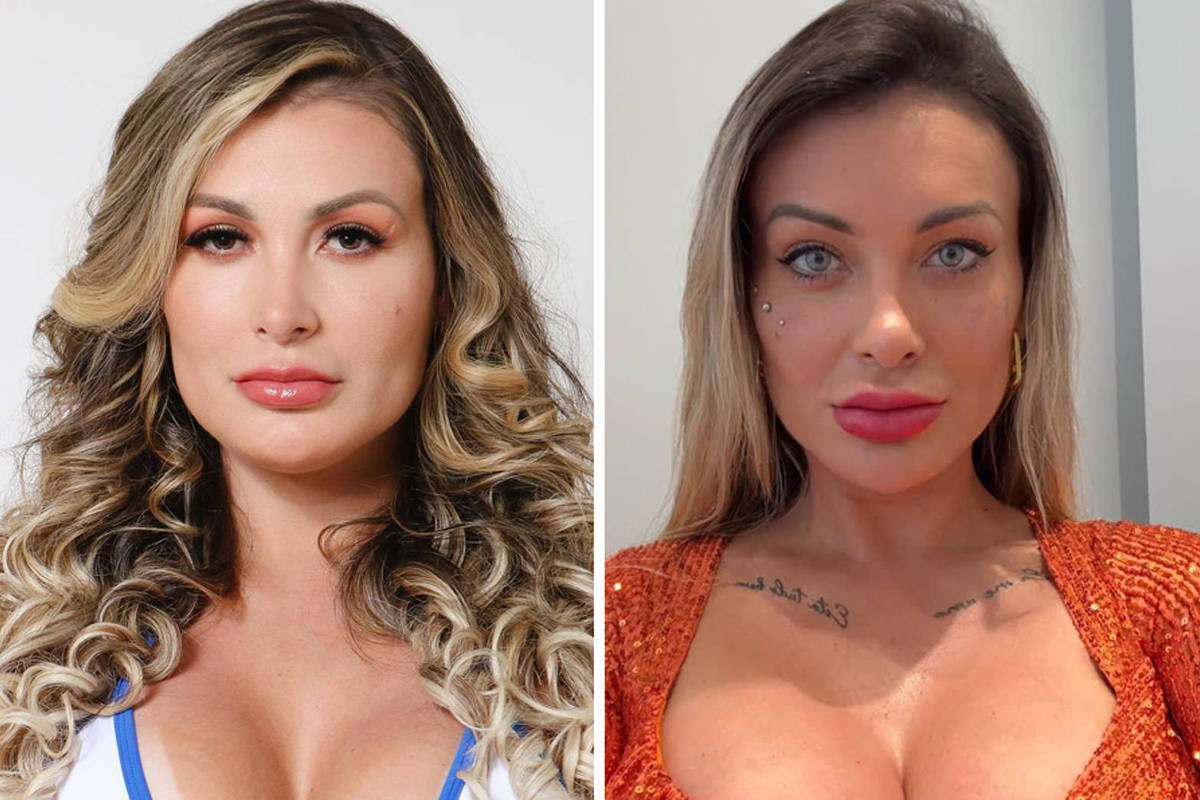 Andressa Urach expressa arrependimento por cirurgia para mudar a cor dos olhos