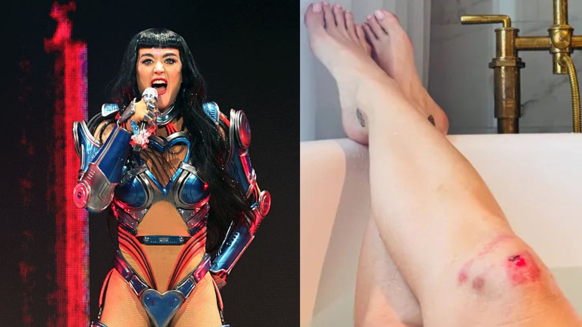 Katy Perry mostra ferimentos após queda no palco durante a Lifetimes Tour
