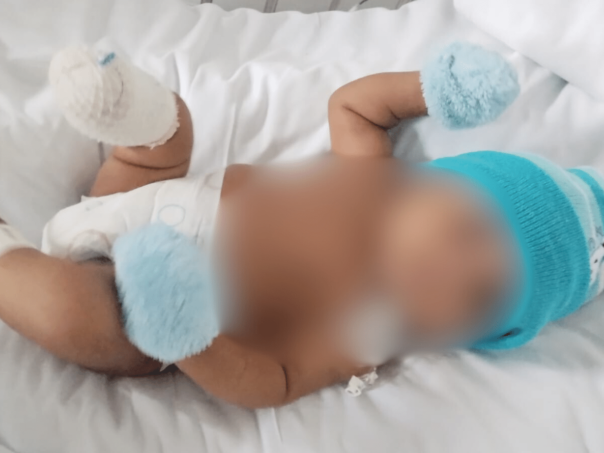 Bebê de 2 meses perde pé após complicações de bronquiolite e mãe denuncia erro médico
