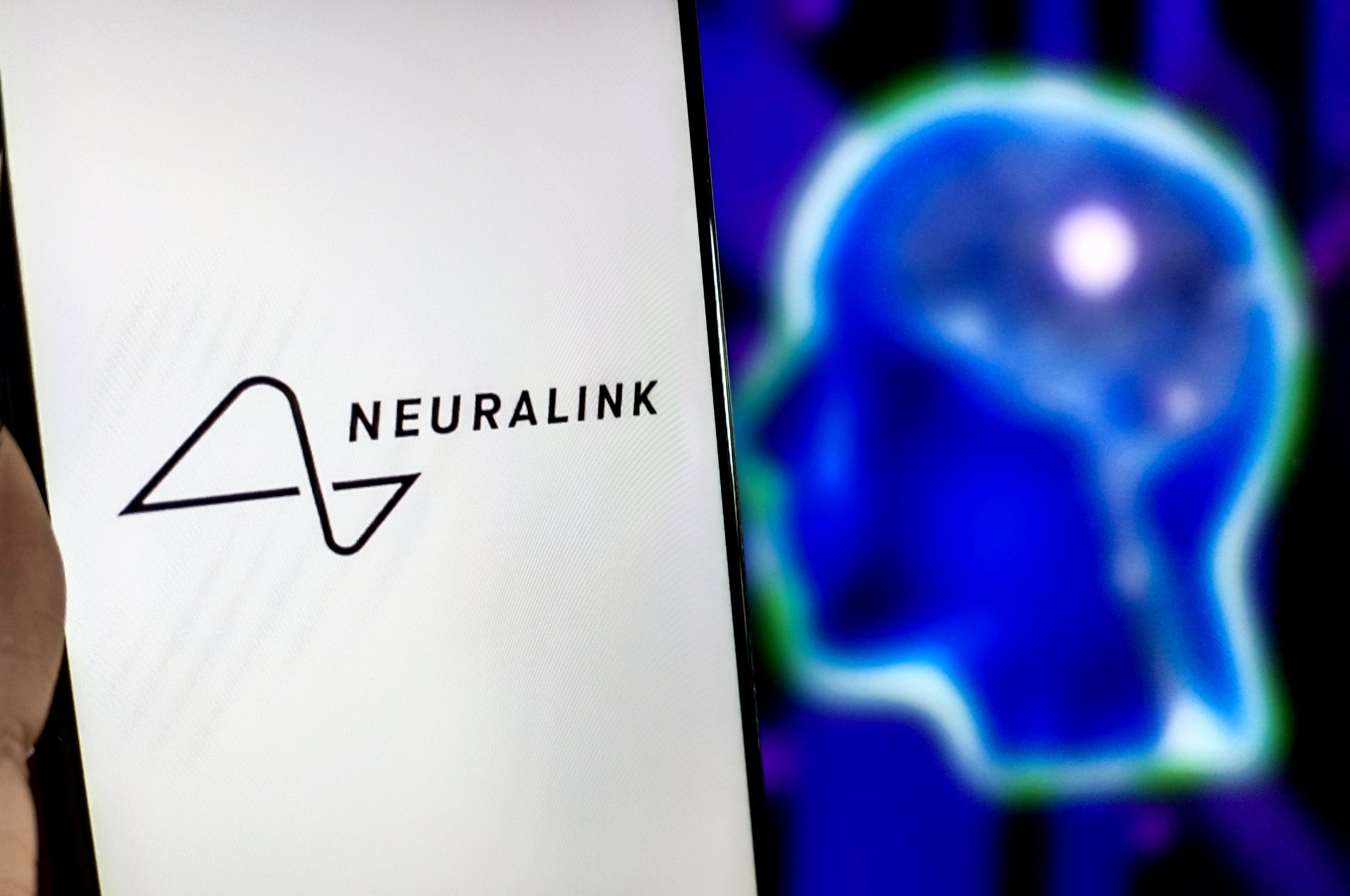 Neuralink inicia estudo clínico no Reino Unido para testar chips em pacientes com paralisia