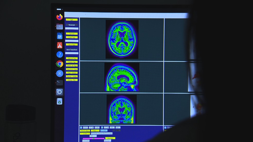 Giovanna Carello Collar venceu prêmio e ganhou bolsa em Harvard por estudo sobre Alzheimer (Foto: Reprodução/RBS TV)