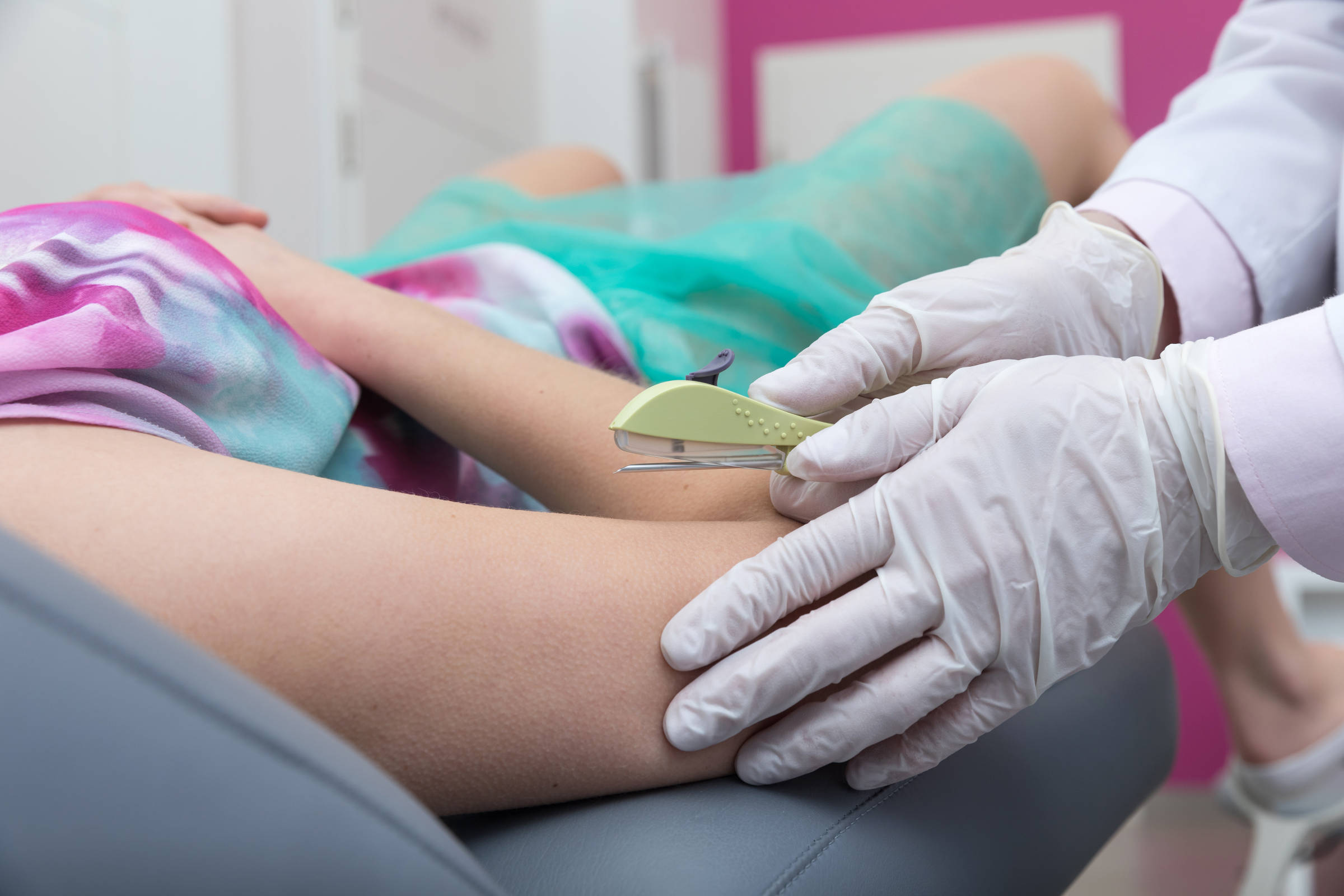 Implanon será disponibilizado no SUS como novo método contraceptivo ainda este ano