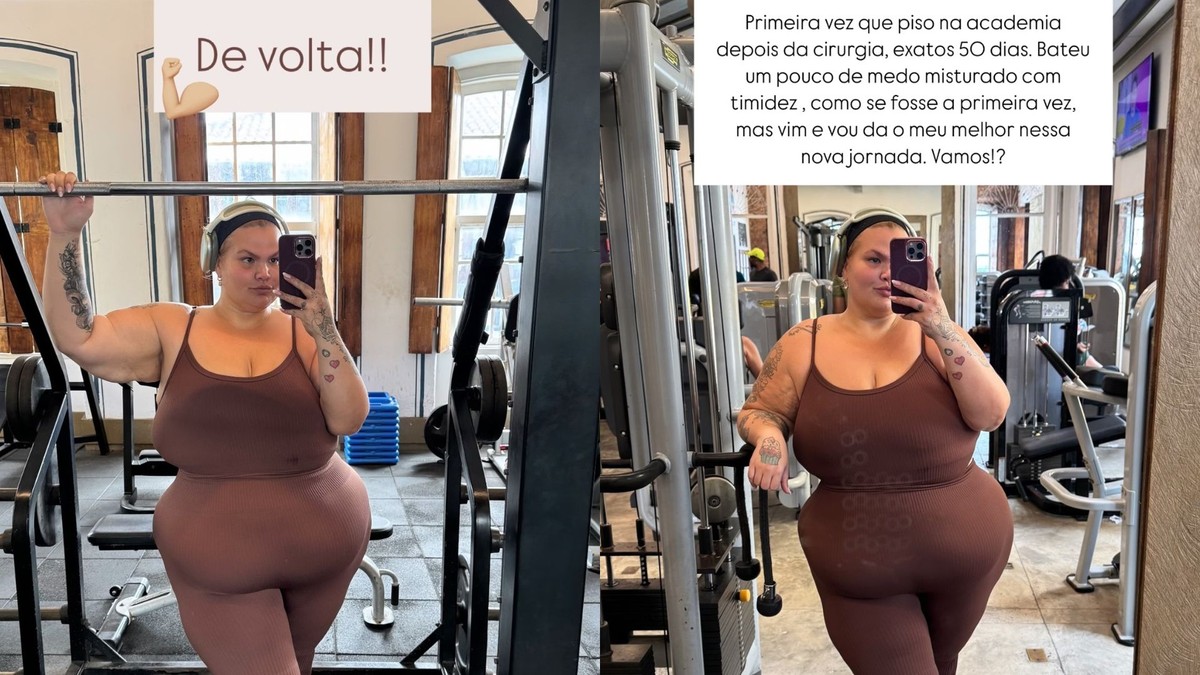 Thais Carla revela dificuldades com queda de cabelo após cirurgia bariátrica