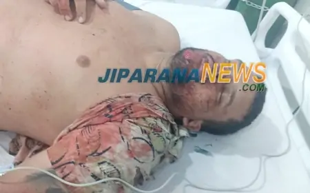 Após Sofrer Queda Durante Chuva, Motociclista é Socorrido Desacordado à Upa