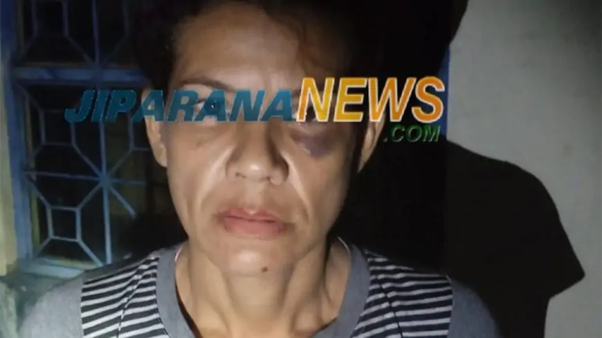 Mulher que foi vítima de Tentativa de Homicídio no bairro Primavera é presa suspeita de está comercializando entorpecentes