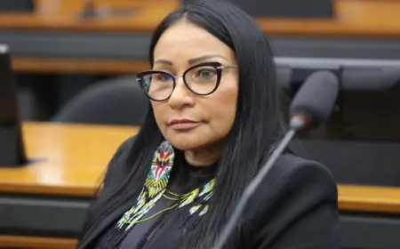 TRE determina cassação de deputada que usou fundo eleitoral para harmonização facial